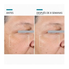 SkinCeuticals A.G.E. Advanced Eye 15 ml | Contorno antiedad