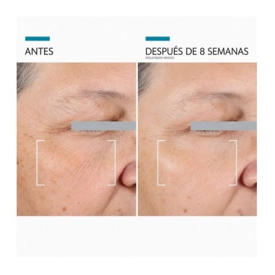 SkinCeuticals A.G.E. Advanced Eye 15 ml | Contorno antiedad