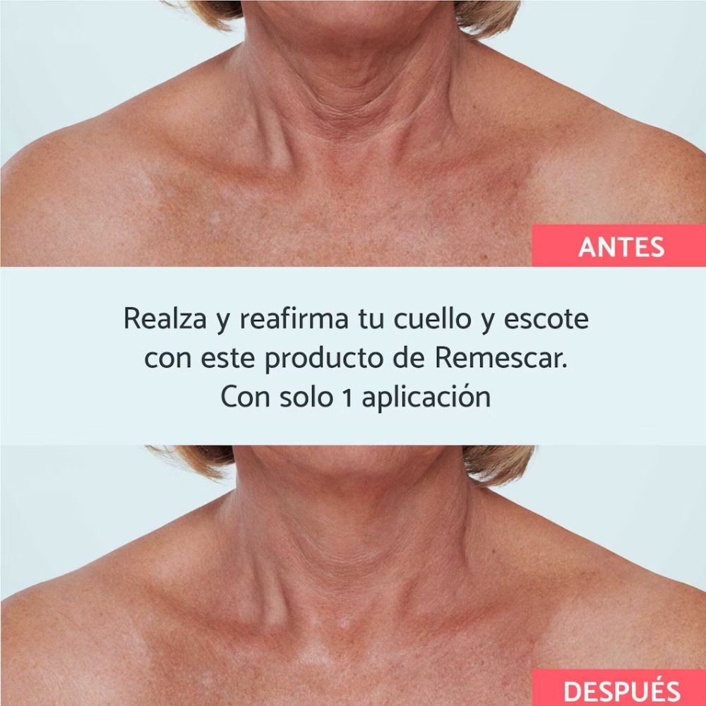 Remescar cuello y escote