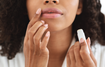 Frío y labios agrietados: guía completa para mantenerlos suaves 